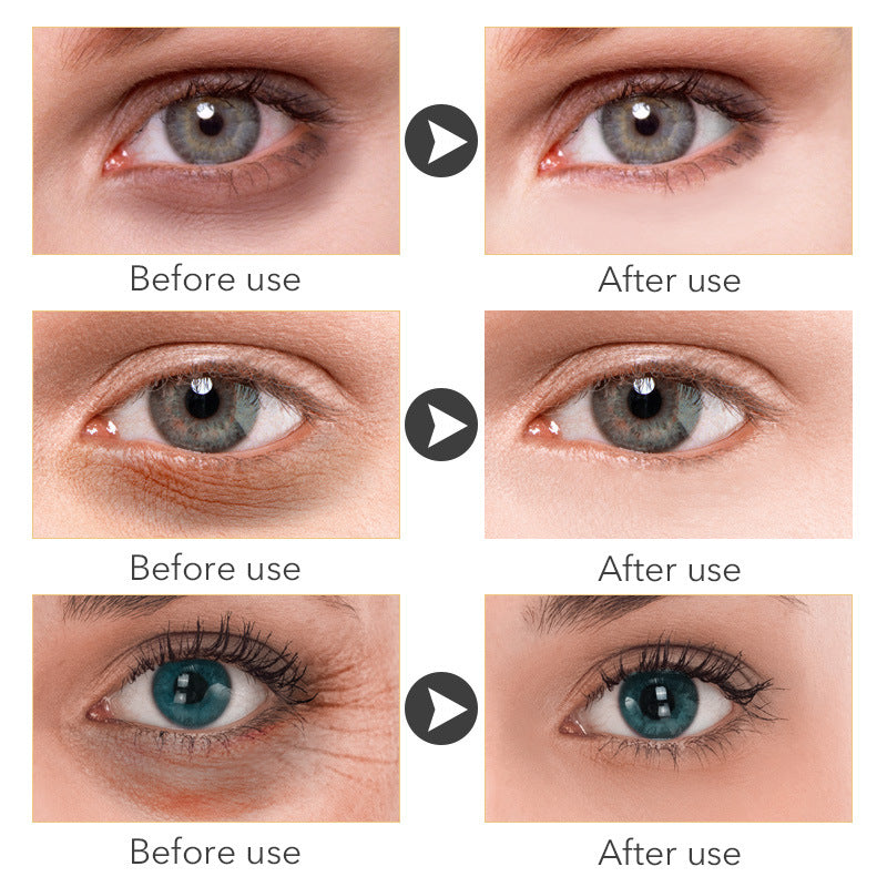 Levi Rhei Revive Eye Cream