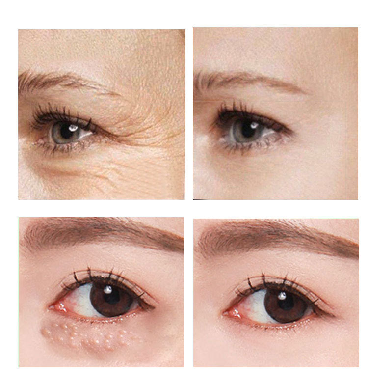 Levi Rhei Revive Eye Cream